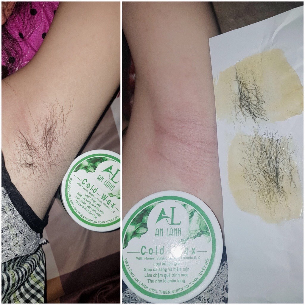 Wax Lông,Wax Lông An Lành 350gr  Kem Tẩy Lông Nách Chân,Was Lông Nách,Triệt Lông Nách Vĩnh Viễn