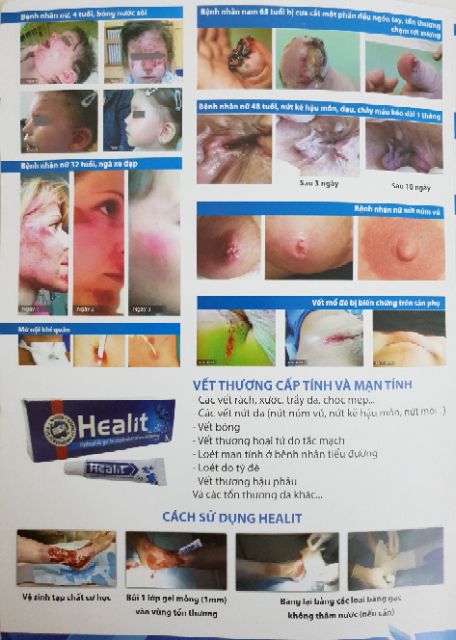 Kem liền vết thương nhanh, chống sẹo lõm HEALIT 5g | BigBuy360 - bigbuy360.vn