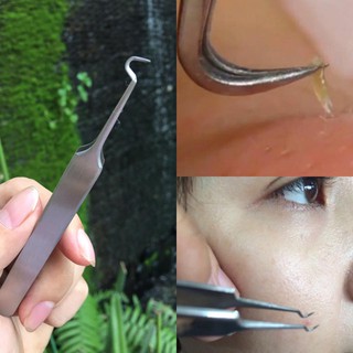 NHÍP GẮP MỤN THÔNG MINH VACOSI