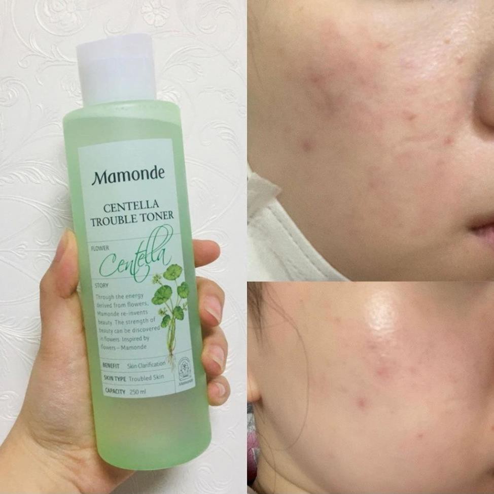 Nước Hoa Hồng Mamonde Diếp Cá Làm Sạch Dầu Nhờn Và Ngăn Ngừa Mụn 250ml