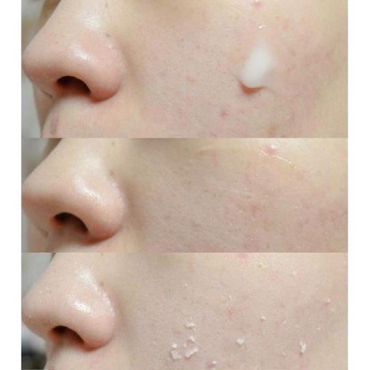 Tẩy da chết Missha Super Aqua D-tox Peeling Gel