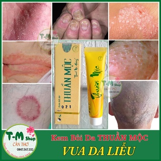 Kem bôi da liễu