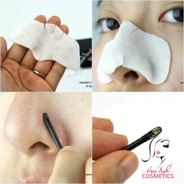 Ủ mụn đầu đen GoodBye Blackhead ciracle