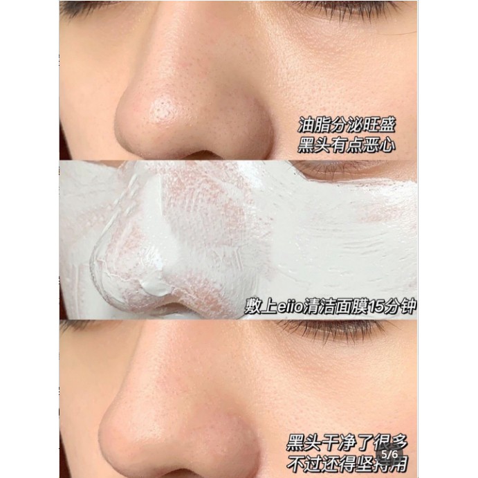 Mặt Nạ Bùn Eiio Làm Trắng Da Làm Sạch Da Lột Mụn Đầu Đen Cho Nữ 100g/ml