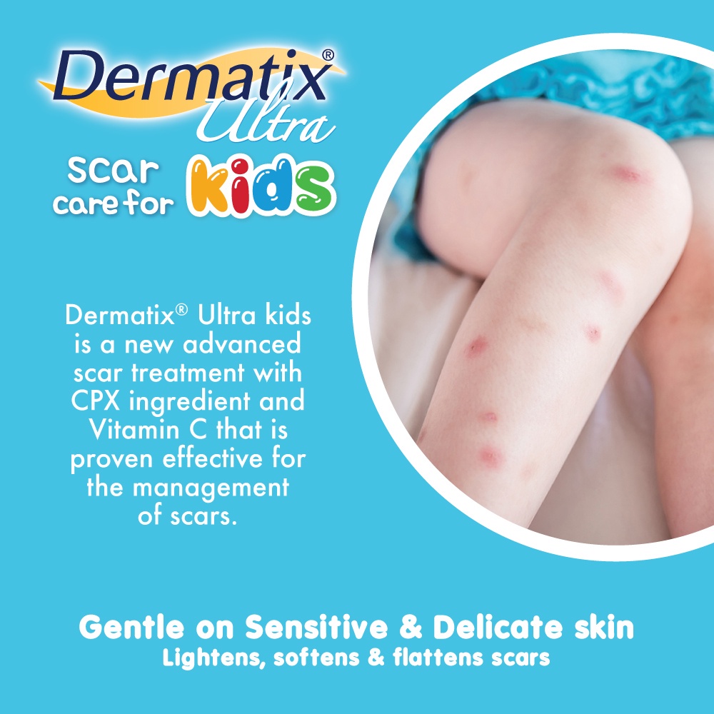 Dermatix Ultra Kids - Gel mờ sẹo dành cho trẻ em 5g