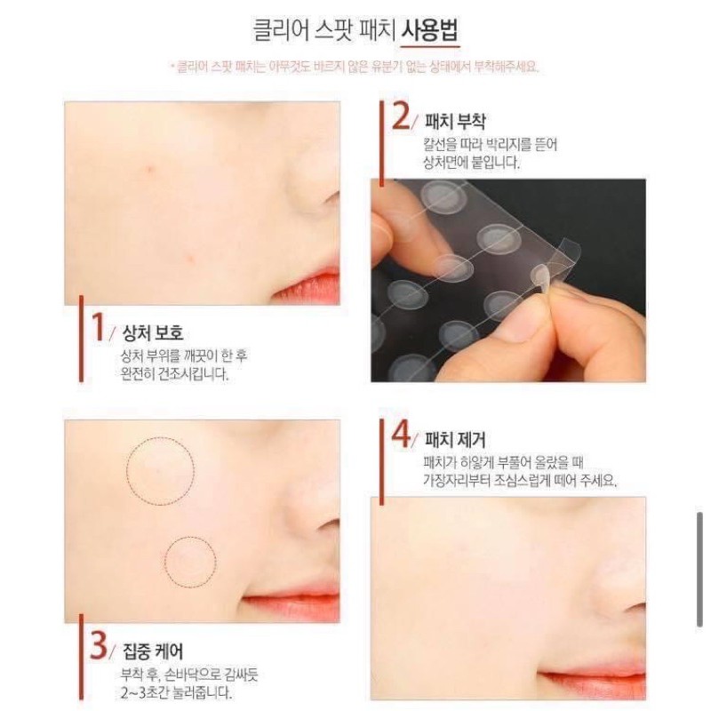 Miếng dán hút mụn So Natural Red-Tock Clear Spot Patch