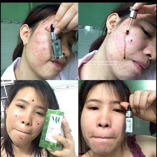 [ Chính hãng] SỮA RỬA MẶT DR MAI mẫu mới 2024