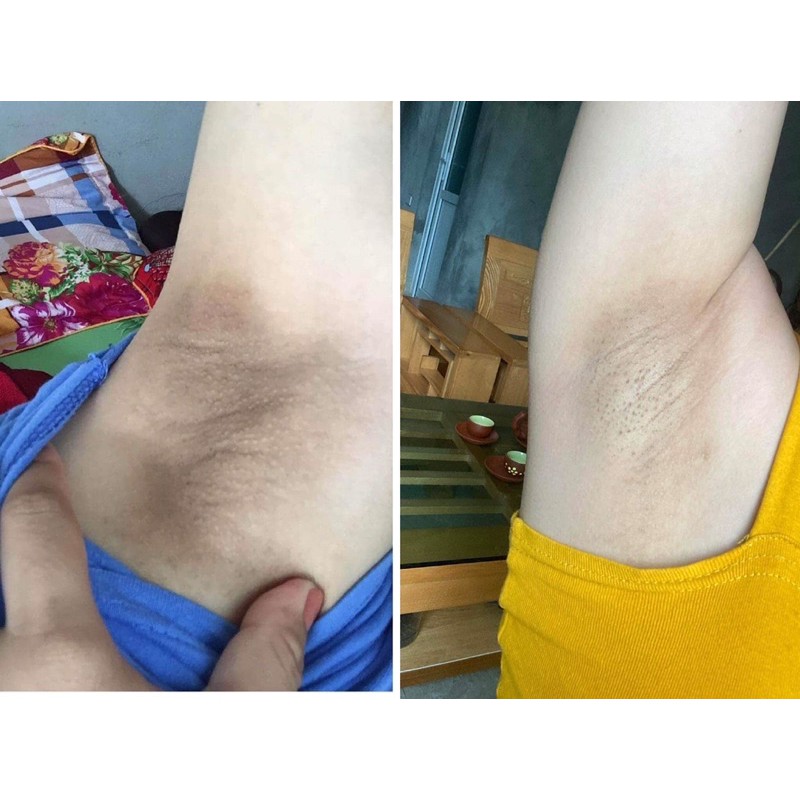 (TẶNG QUÀ)Kem triệt mùi hôi nách, thâm nách Cô Bơ | BigBuy360 - bigbuy360.vn