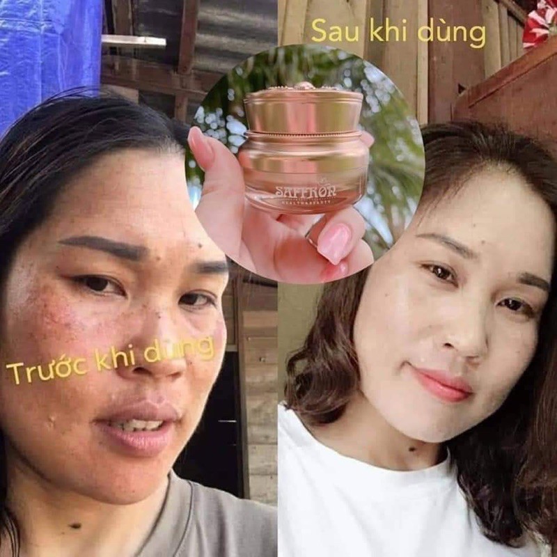 Kem Nám Saffron- Chính hãng Hải Âu Việt