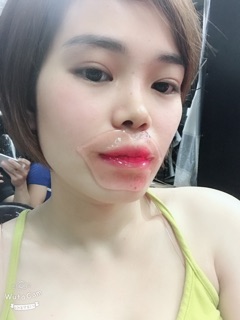 Mask Môi - Nội địa trung
