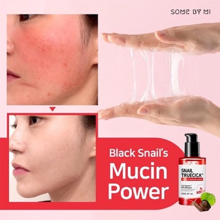Serum phục hồi mờ thâm sẹo Somebymi