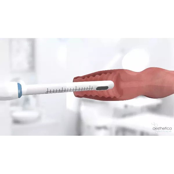 Công nghệ trẻ hóa vùng kín HIFU