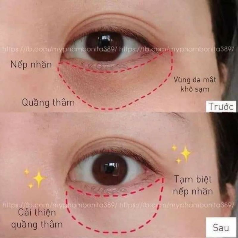 Hộp 60 Miếng Mặt Nạ Dưỡng Mắt Bioaqua | BigBuy360 - bigbuy360.vn