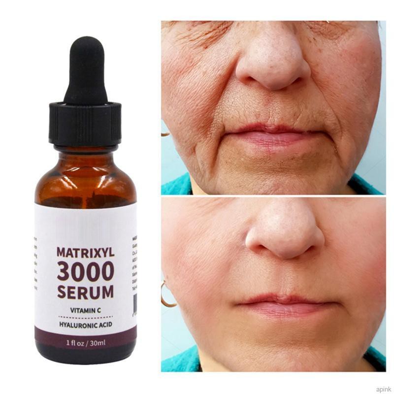 Serum Hyaluronic Acid MATRIXYL 3000 Vitamin C Giảm Nếp Nhăn Chăm Sóc Da Mặt 30ml