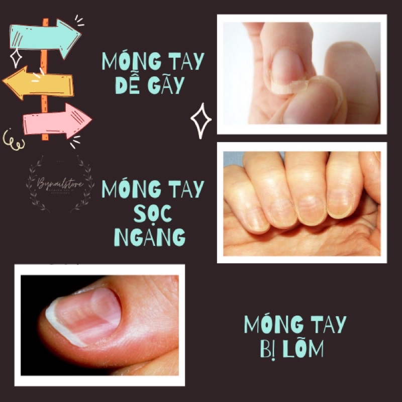 [G-gelly] Dưỡng móng cao cấp Hàn Quốc khô tự nhiên 14ml ( 1pcs)