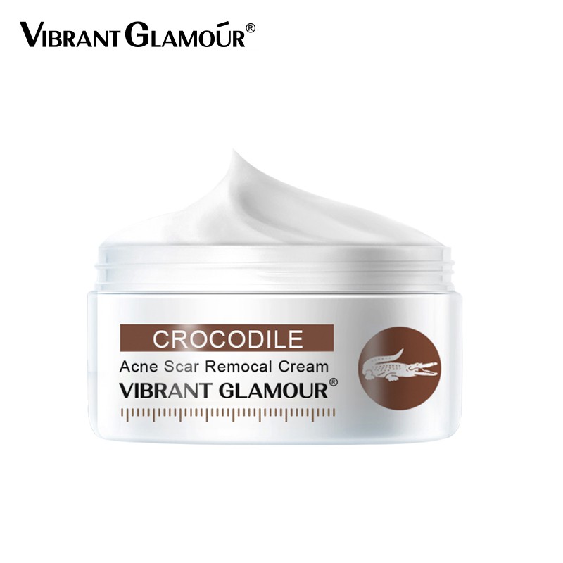 Kem Loại Bỏ Sẹo VIBRANT GLAMOUR Giảm Vết Rạn / Mụn / Đốm Làm Trắng Da Dưỡng Ẩm Chống Nếp Nhăn Không Nhờn Rít 30g