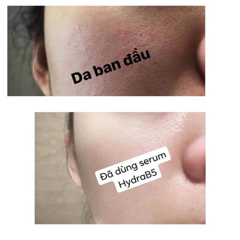 SERUM HYDRAB5 HEMIA- NHAU THAI HEO ĐỈNH CAO DƯỠNG ẨM- PHỦ SƯƠNG CĂNG BÓNG | BigBuy360 - bigbuy360.vn