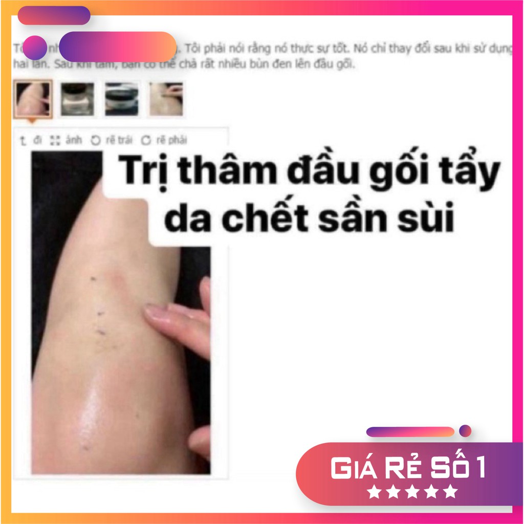 Kem Che Phủ Thâm Pibamy- Kem Phủ Thâm Đầu Gối, Khuỷu Tay, Nách, Mắt Cá Chân | BigBuy360 - bigbuy360.vn