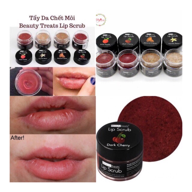 TẨY DA CHẾT MÔI BEAUTY TREATS mỹ