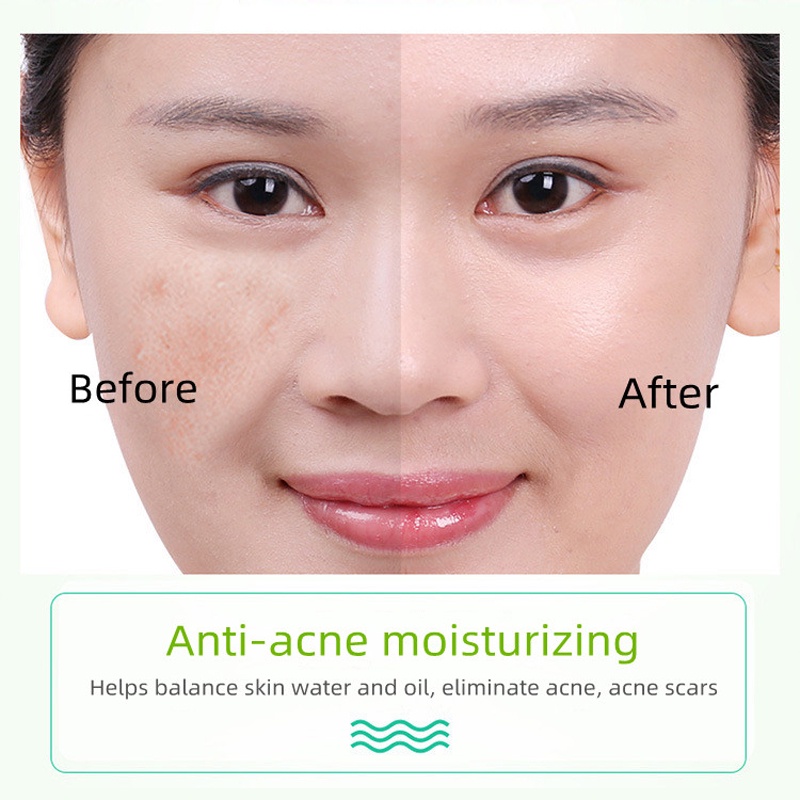 Gel lô hội SEVICH dưỡng ẩm hỗ trợ giảm mụn 40g
