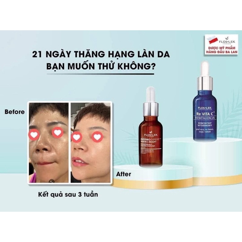Serum trắng da, chống lão hóa Floslek Re Vita C cho da chảy sệ, nếp nhăn, da mất nước, xỉn màu kém sức sống & thâm mụn