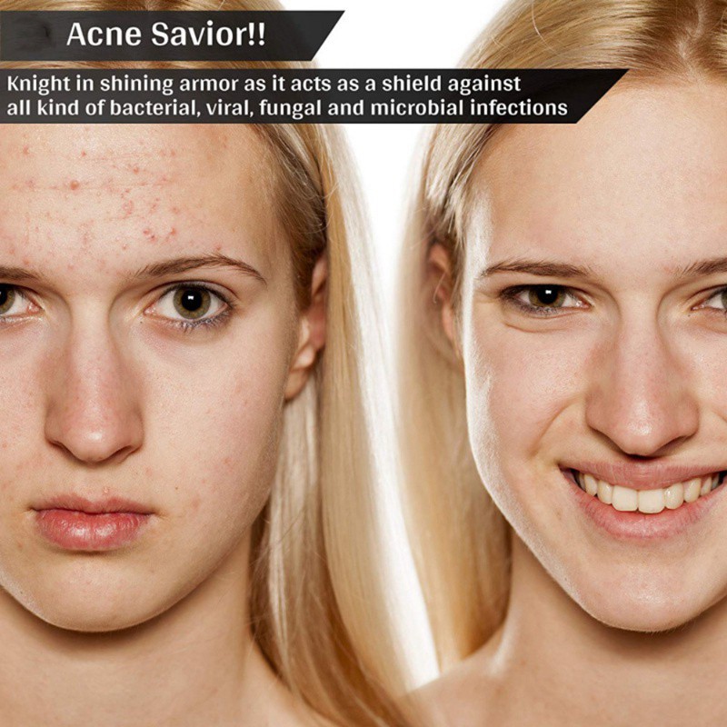 [Hàng mới về] Tinh dầu tràm trà hỗ trợ giảm sẹo mụn dưỡng ẩm kiềm dầu cho da | BigBuy360 - bigbuy360.vn