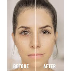 Sample Kem Dưỡng Mắt Kiehl's Youth Dose Eye Treatment Gói 1,5ml | BigBuy360 - bigbuy360.vn