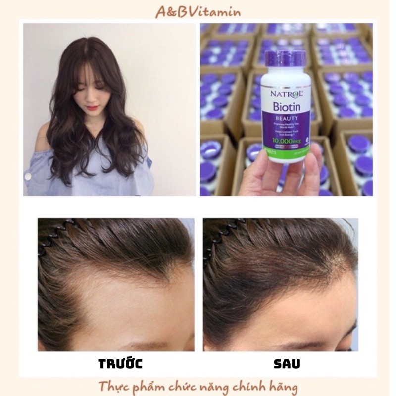 Viên uống mọc tóc Biotin Natroe 10.000mcg (Hàng Mỹ)