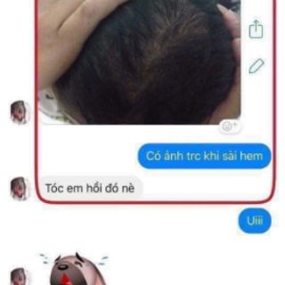XỊT TÓC THUỐC BẮC 22 VỊ
