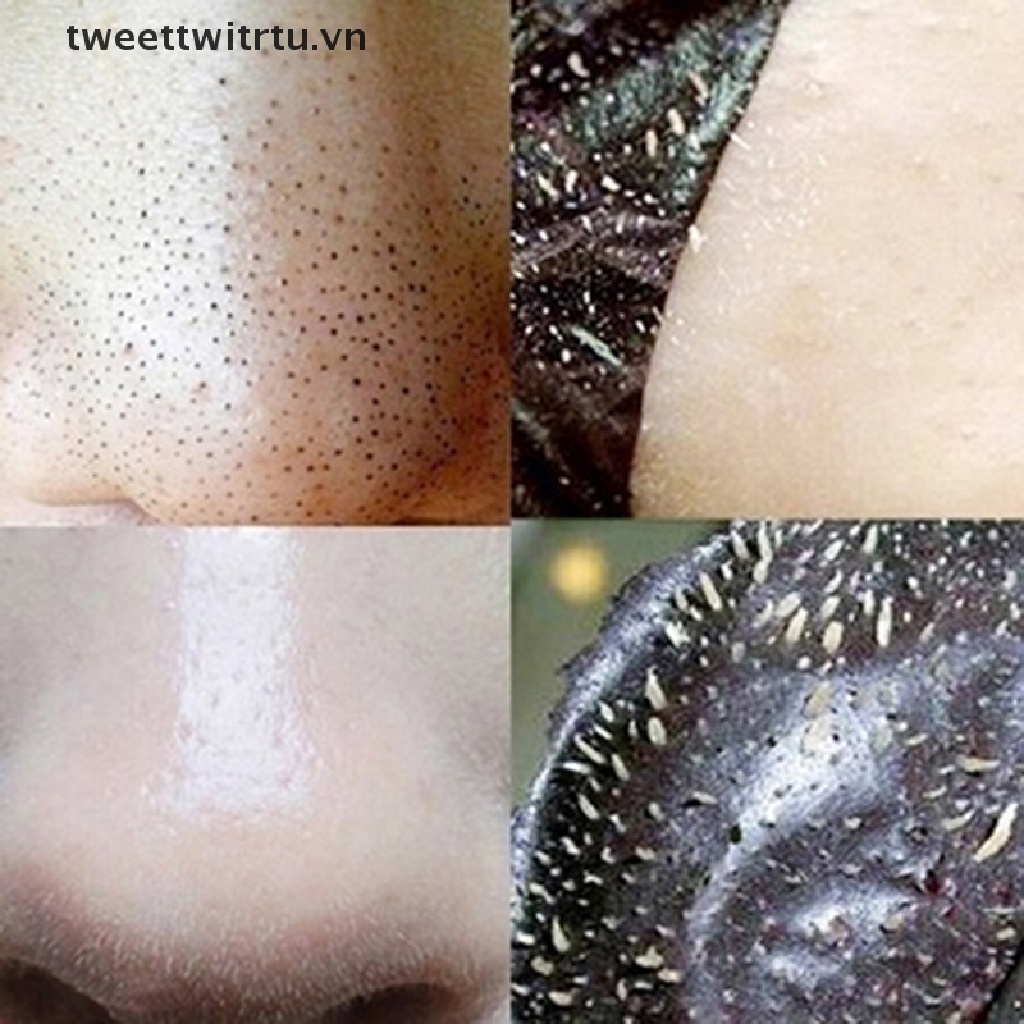 Set 10 Mặt Nạ Lột Mụn Đầu Đen Vùng Mũi Thu Nhỏ Lỗ Chân Lông Làm Sạch Sâu TRWITU