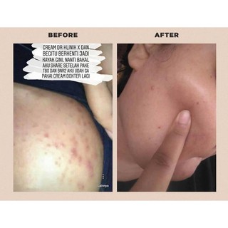 💦💦Sữa rửa mặt rau má 𝗦𝗸𝗶𝗻𝟭𝟬𝟬𝟰 𝗠𝗮𝗱𝗮𝗴𝗮𝘀𝗰𝗮 Centella Ampoule Foam💦💦
