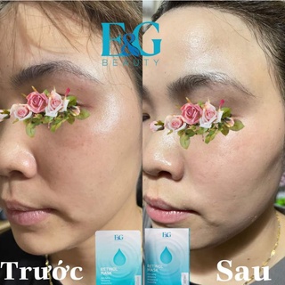 Mặt Nạ Retinol - E&G Beauty
