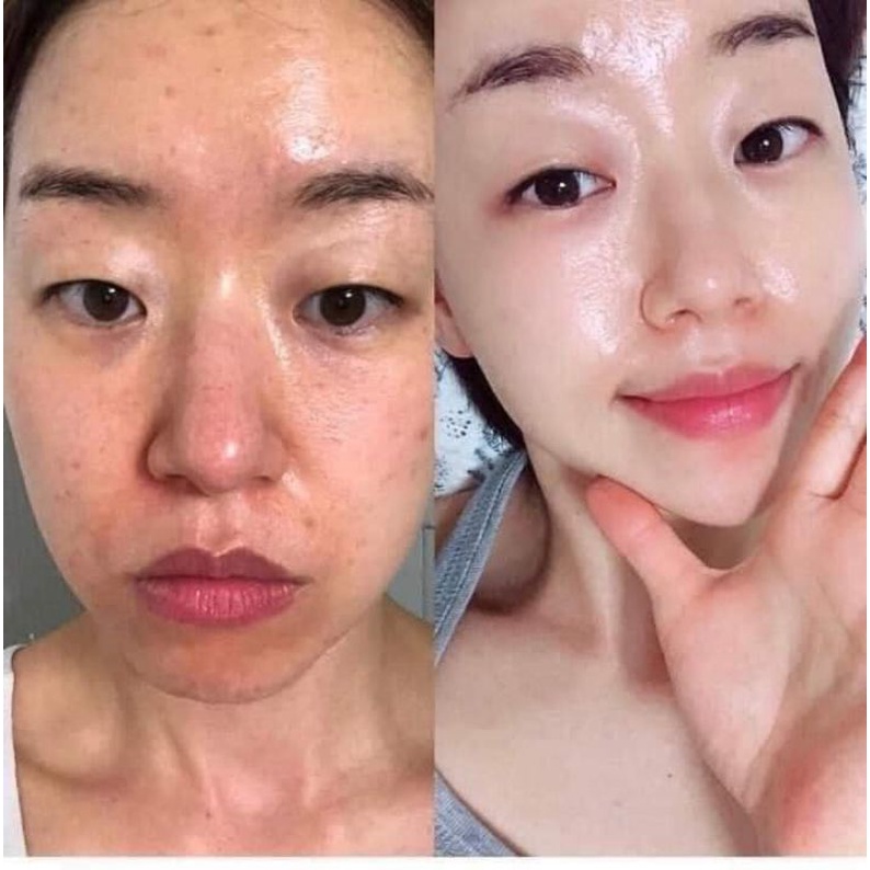 Kem hạn chế Nám Guiche colagen tone up whitening cream Hàn Quốc