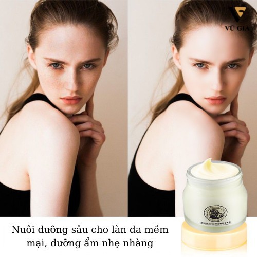 Kem Dưỡng Ẩm, Kem Dưỡng Trắng Da Mặt Mỡ Cừu LAIKOU Chống Lão Hóa 90g | BigBuy360 - bigbuy360.vn