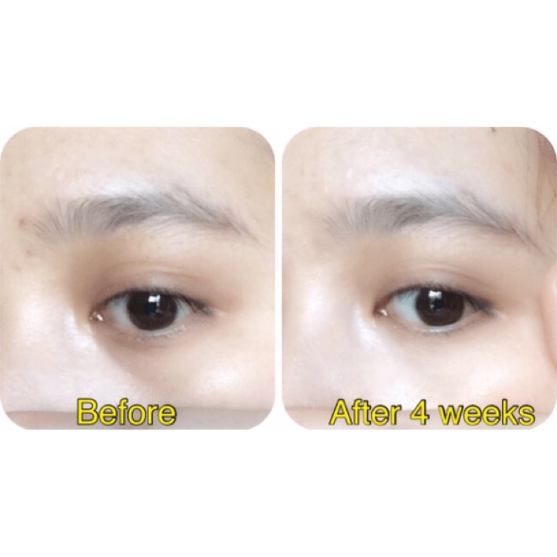 Kem dưỡng mắt Balance Active Formula Snake Venom Eye Cream | BigBuy360 - bigbuy360.vn