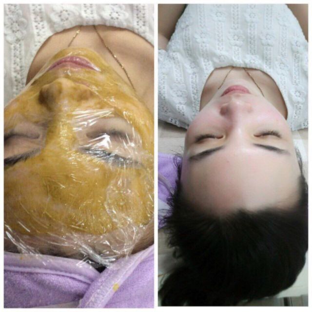 Bộ mầm tái sinh Hàn Quốc