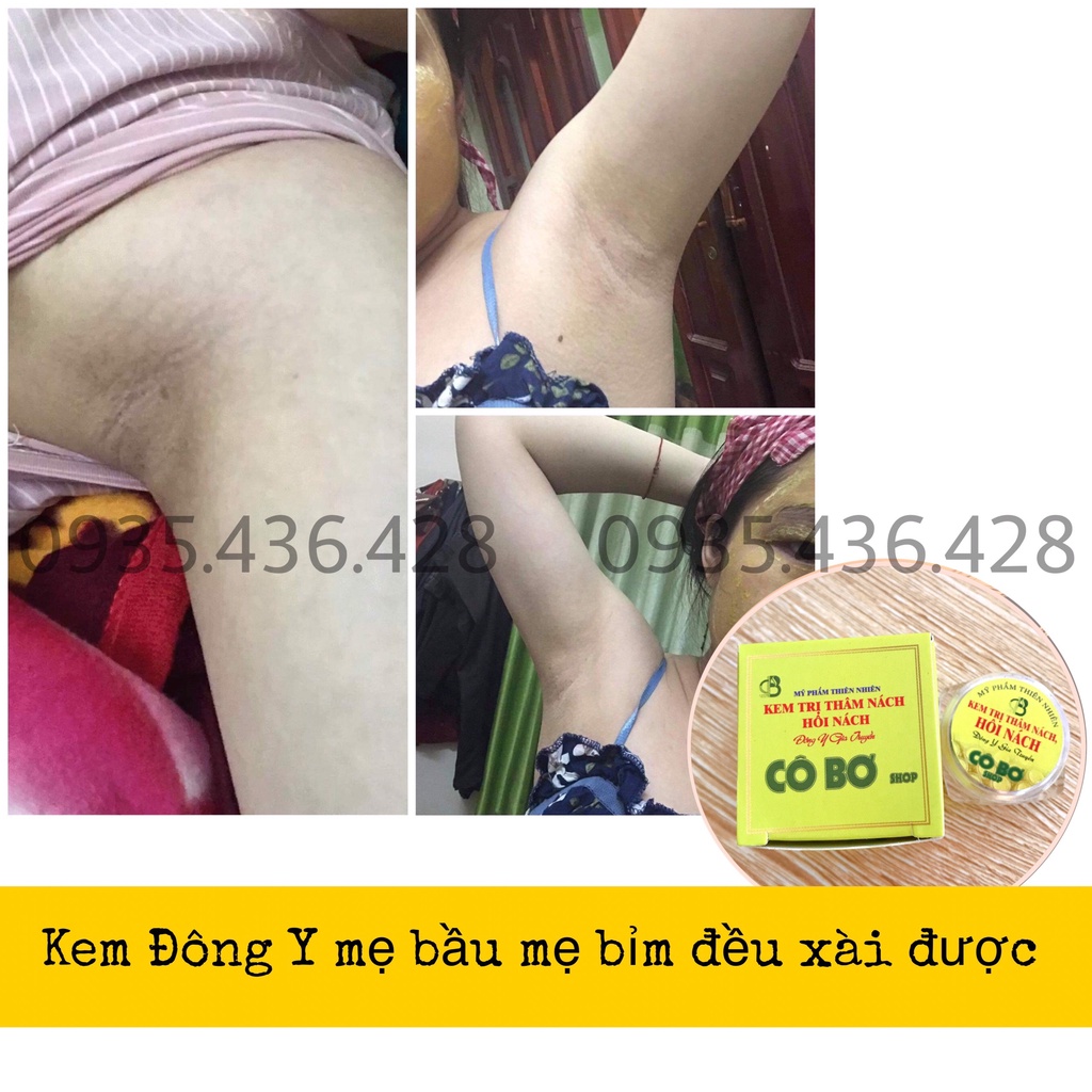 Khử Thâm Nách Hôi Nách ⚡FREE SHIP⚡ Kem Cô Bơ Chiết Xuất Từ Thiên Nhiên 100%, mẹ bầu, mẹ bỉm đều xài được