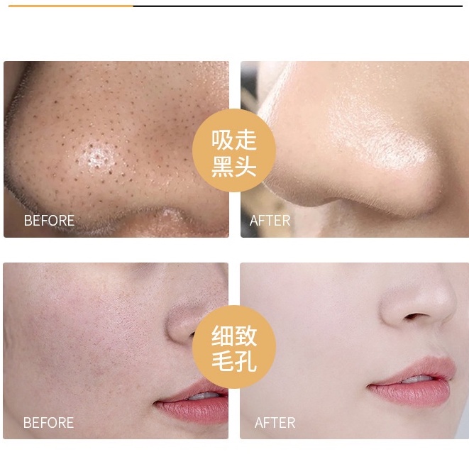 Mặt Nạ Bùn Lột Mụn Đầu Đen Dưỡng Ẩm Làm Sạch Lỗ Chân Lông
