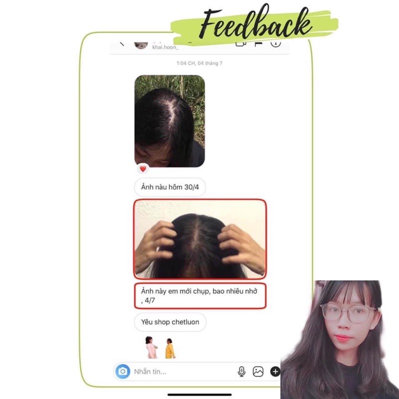 (𝑻𝑨̣̆𝑵𝑮 𝑪𝑶̣̂𝑻 𝑻𝑶́𝑪 𝑿𝑰𝑵𝑯) XỊT BƯỞI VIJULLY KÍCH MỌC TÓC, NGĂN NGỪA RỤNG VÀ THƯA HÓI TÓC | BigBuy360 - bigbuy360.vn