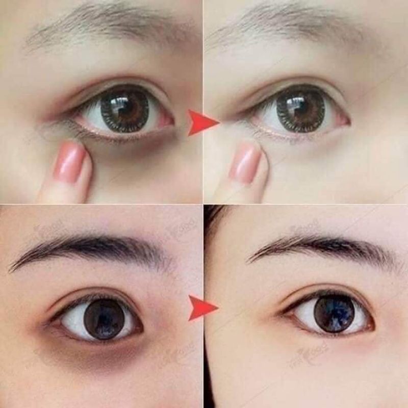 Kem Giảm Nhăn Và Thâm Quầng Vùng Da Quanh Mắt Ohui Age Recovery Eye Cream
