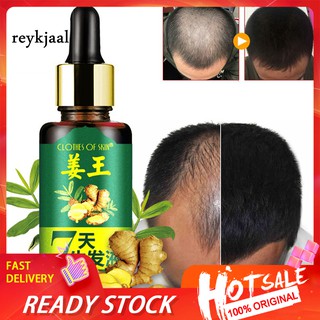[Hàng mới về] Tinh dầu gừng giúp cung cấp dưỡng chất chăm sóc mọc tóc trong 7 ngày