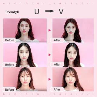 Bộ 40 Miếng Dán Mặt V-Line