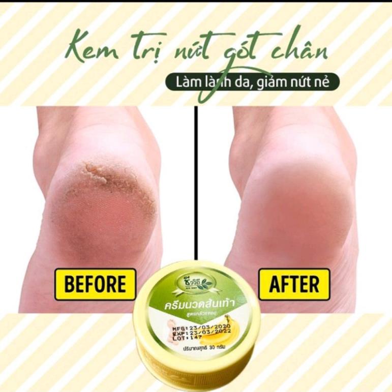 Kem bôi nứt gót chân Chuối Thái Lan