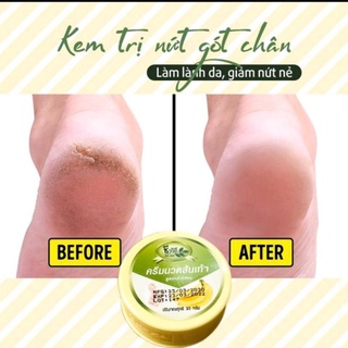 Kem bôi nứt gót chân Chuối Thái Lan