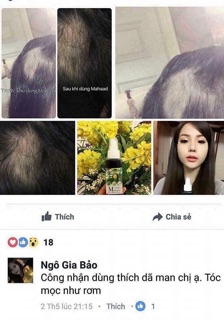 TINH DẦU MỌC TÓC MAHAAD