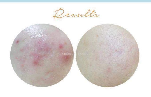 Tinh chất trắng da mờ thâm viamin C Klairs Freshly Juice Vitamin Drop - LAMII BEAUTY