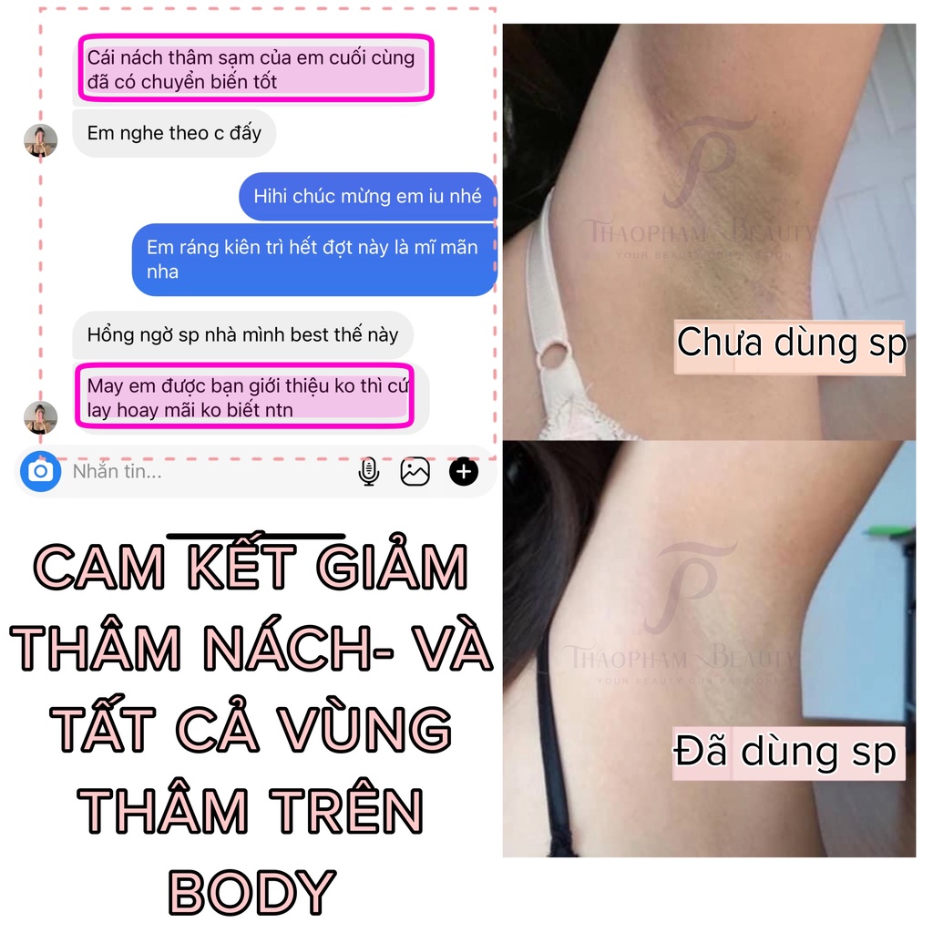 Kem làm mờ thâm vùng dưới cánh tay/đầu gối, dưỡng trắng da body Retinol Butter Cream Sweet Baby 220ml – Thảo Phạm Beauty