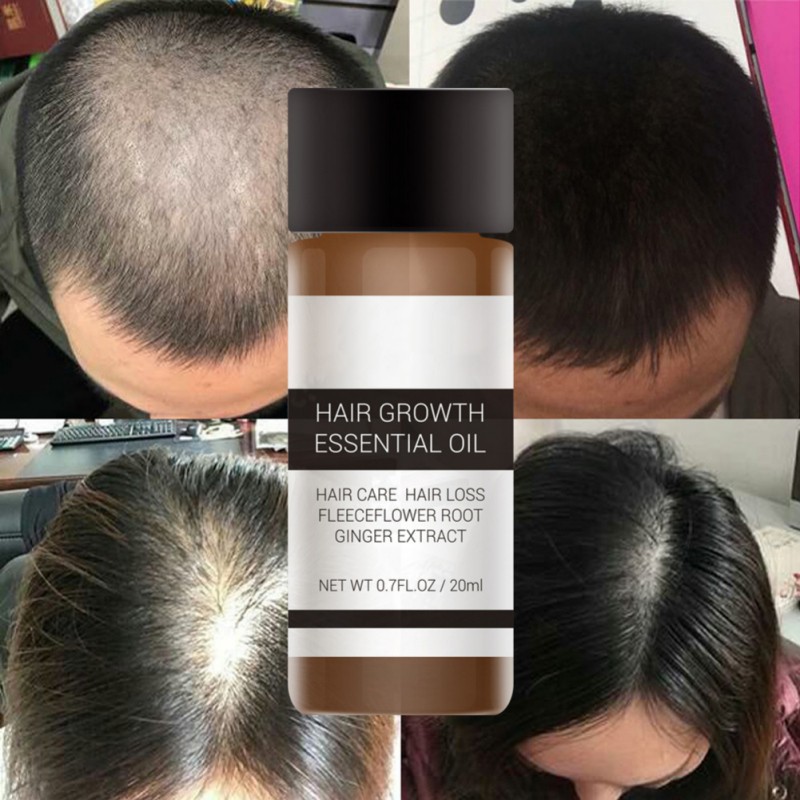 LANBENA Tinh chất kích thích mọc tóc nhanh 20ml