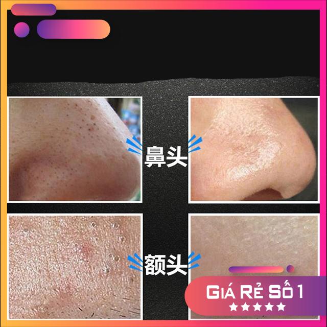 Gel lột Mụn Than Tre HANKEY Bamboo Charcoal Sáng da- Sạch mụn - Thải độc chì 70gr