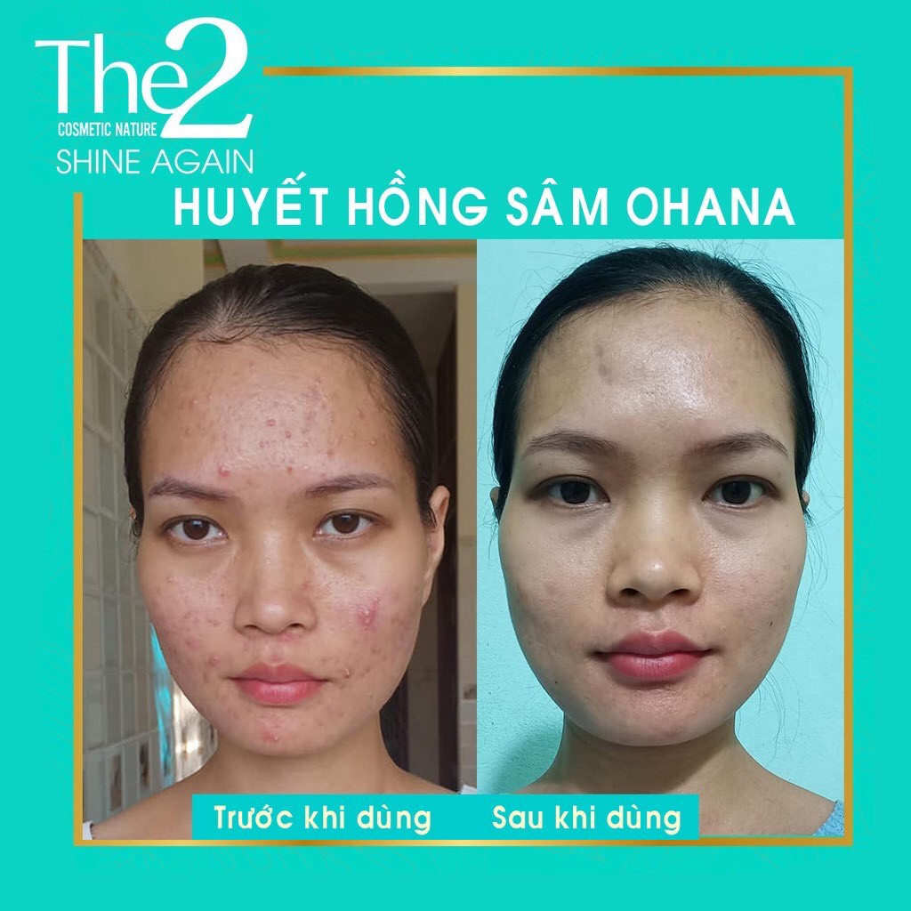 Huyết Hồng Sâm 10ml Đông Dược Vũ Đức [HÀNG CHÍNH HÃNG] | BigBuy360 - bigbuy360.vn